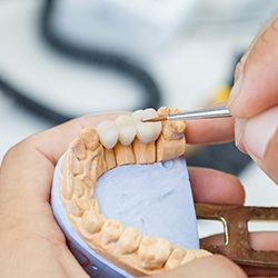 Sagamore Hills dentist creating dental crowns