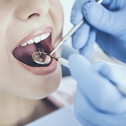 Dentist using dental tools to examine patient's teeth