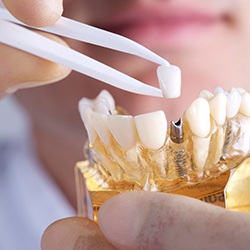 dentist placing a crown on top of a dental implant post 