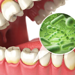 Image of bacteria under the gums