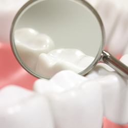 Closeup of teeth with dental sealants