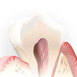 Animation of the inside of the tooth
