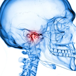 Red, highlighted jaw joint on X-ray of a skull