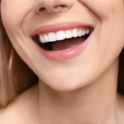 Woman's beautiful smile with veneers in Sagamore Hills