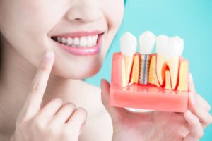 dentist pointing to model with dental implants in Sagamore Hills